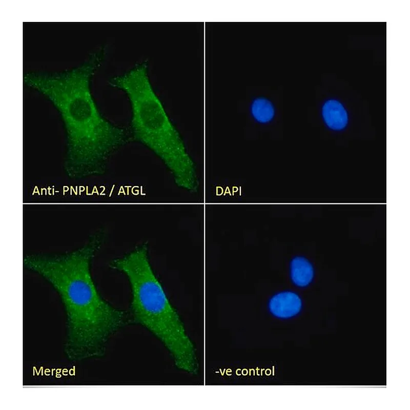 Merck Anti-PNPLA2/ATGL antibody produced in goat