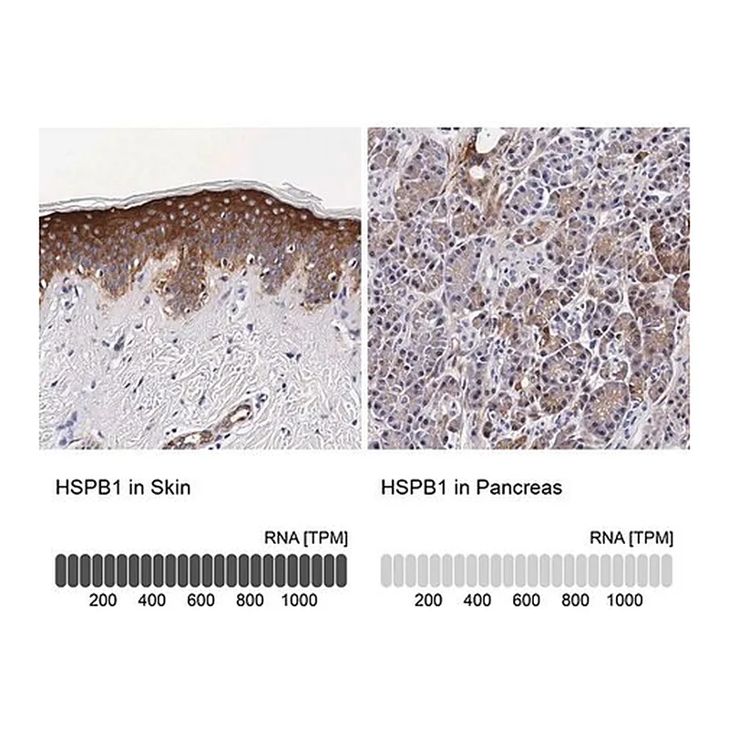 Merck Anti-HSPB1 antibody produced in rabbit