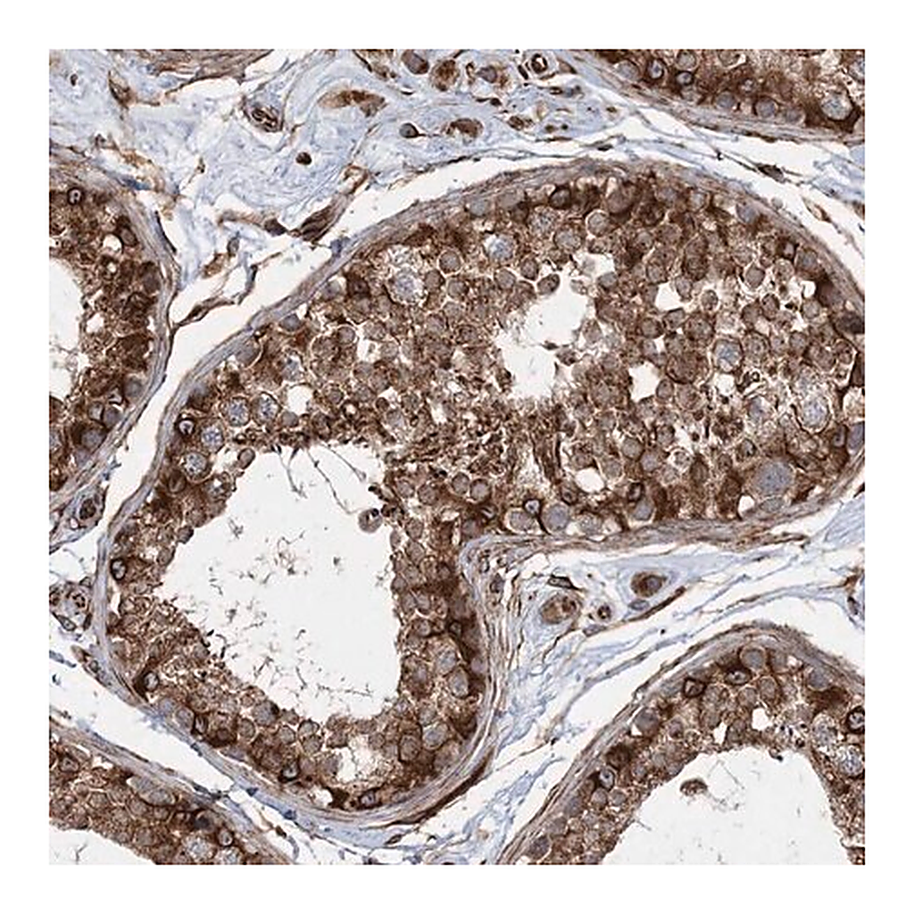 Merck Anti-FAM114A2 antibody produced in rabbit