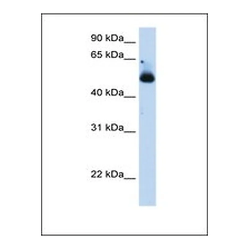 Merck Anti-TRIM21