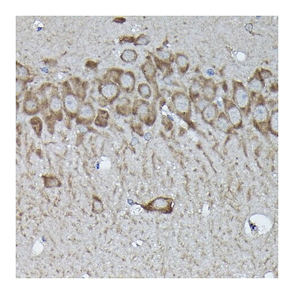 Merck Anti- Calreticulin antibody produced in rabbit