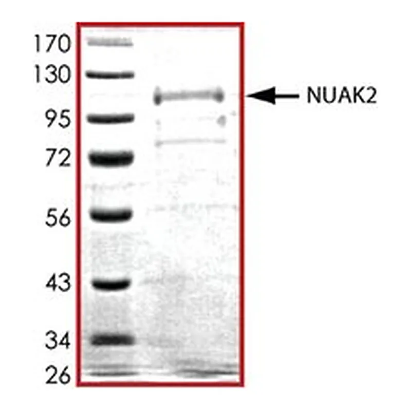 Merck NUAK2, ACTIVE, GST TAGGED, HUMAN