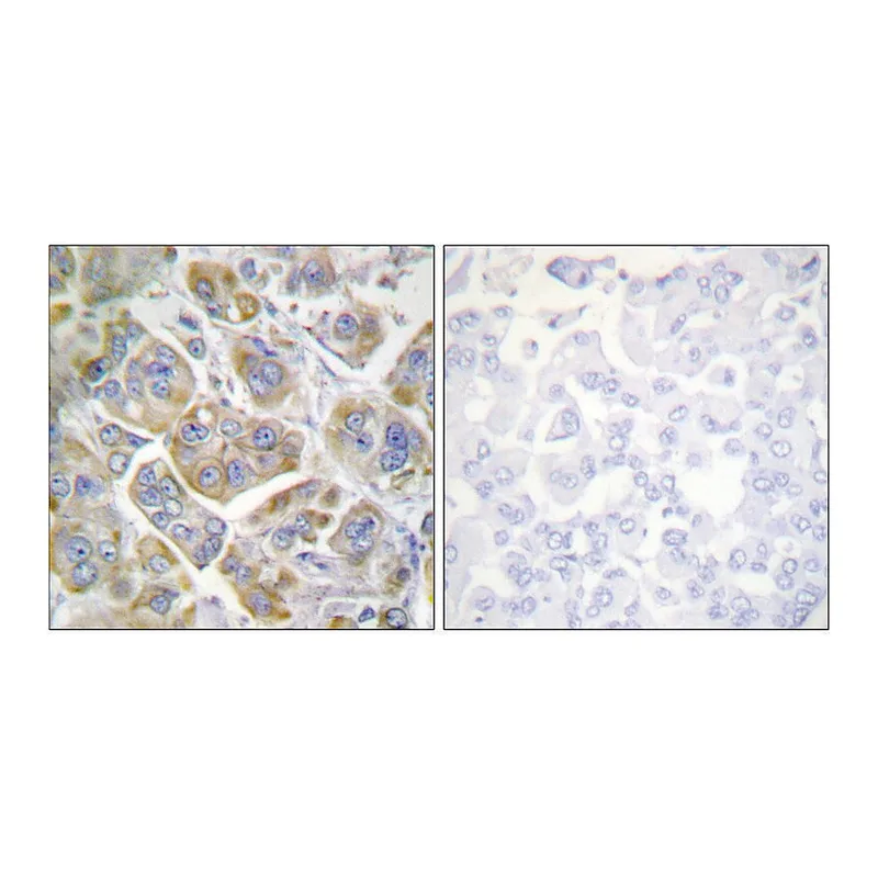 Merck Anti-Integrin beta4 antibody produced in rabbit
