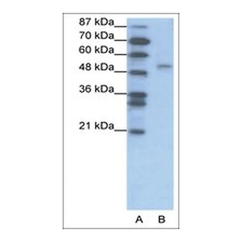 Merck Anti-FOXD2