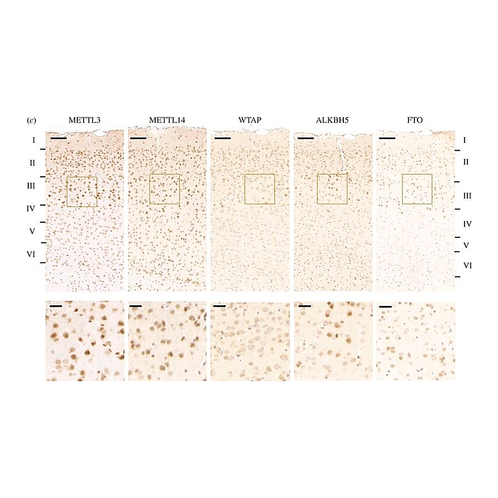 Merck Anti-ALKBH5 antibody produced in rabbit