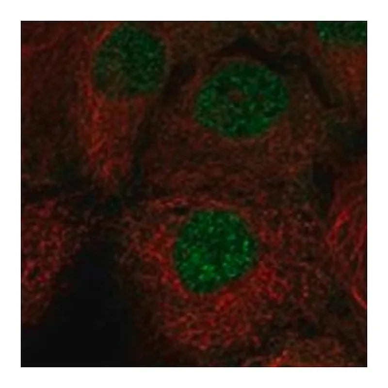 Merck Anti-CTNNBL1 antibody produced in rabbit