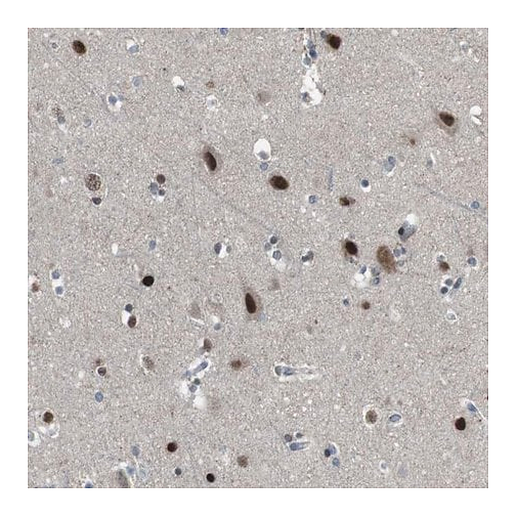 Merck Anti-ARID5B antibody produced in rabbit