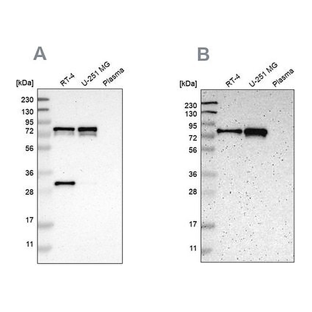 Merck Anti-MTDH antibody produced in rabbit