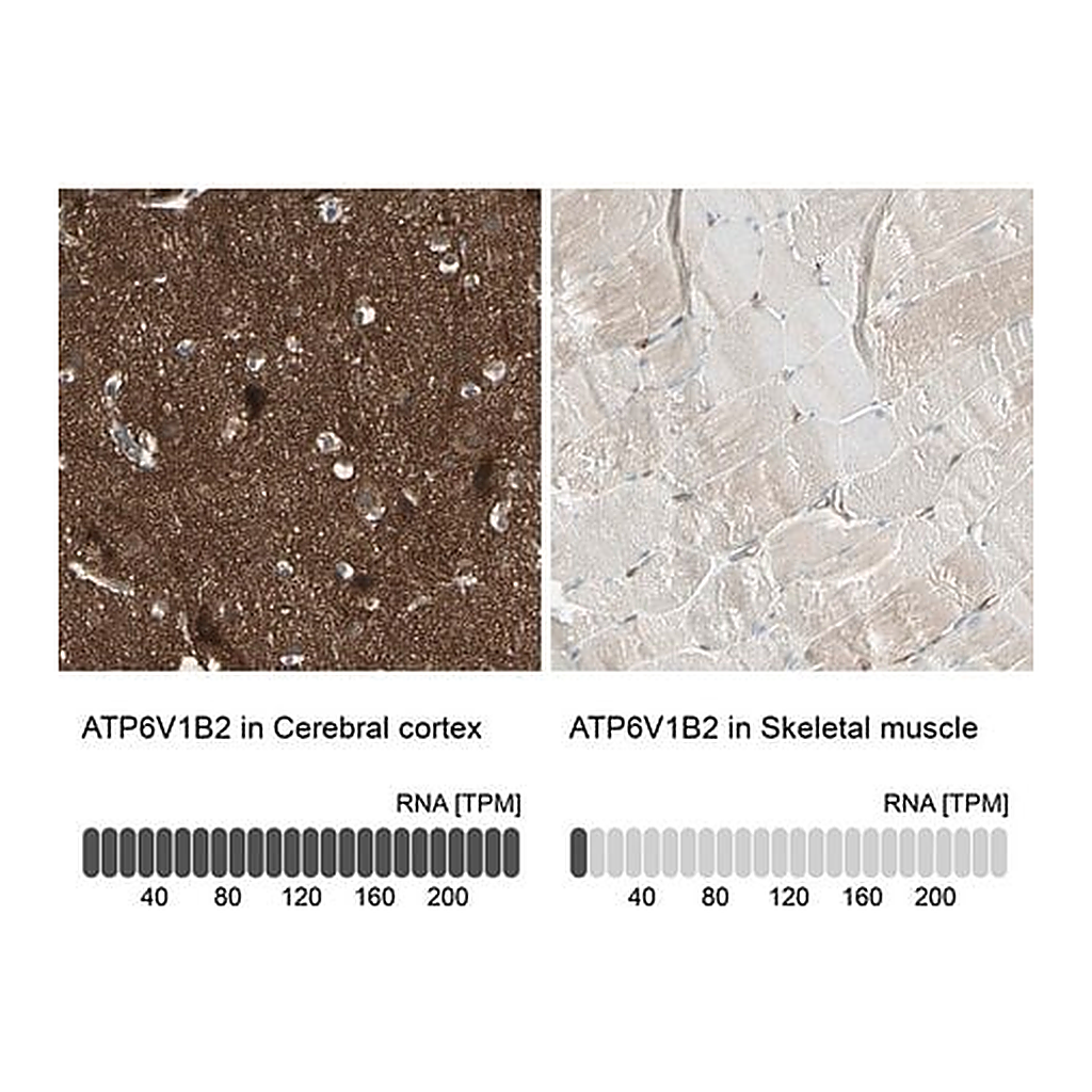 Merck Anti-ATP6V1B2 antibody produced in rabbit