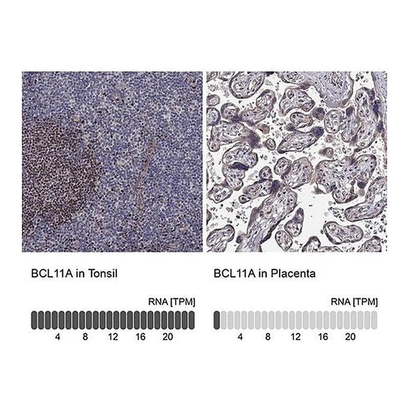 Merck Anti-BCL11A antibody produced in rabbit