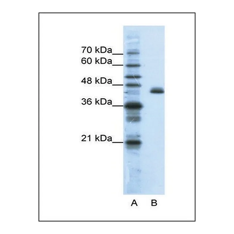 Merck Anti-ZFP36L2 antibody produced in rabbit