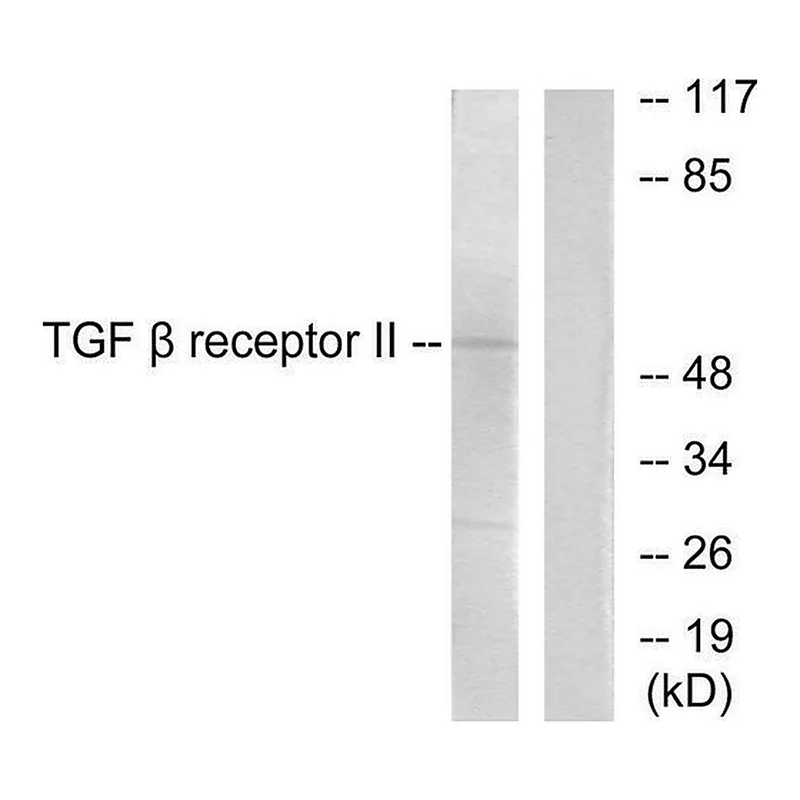 Merck Anti-TGF beta Receptor II antibody produced in rabbit