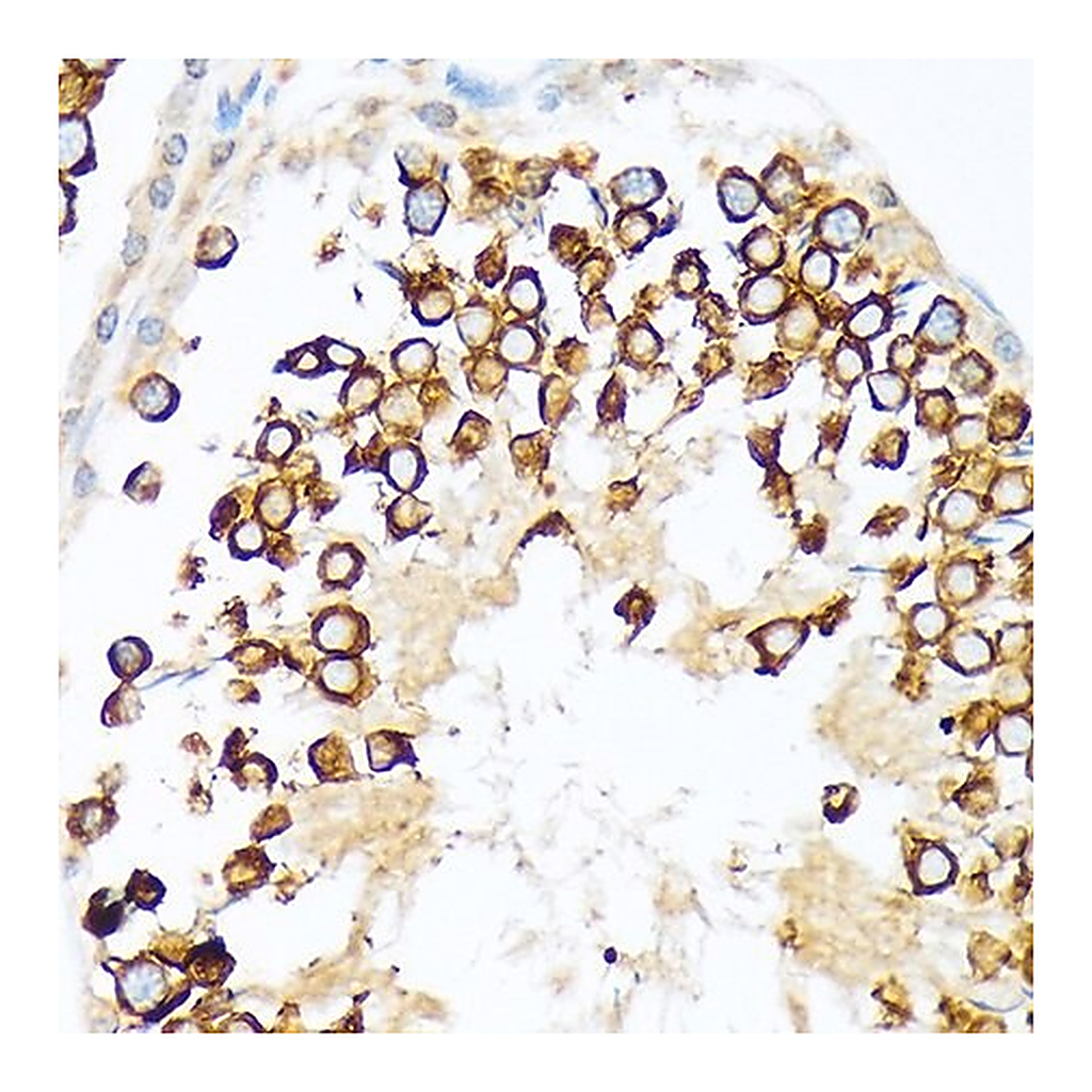Merck Anti-Calmegin antibody produced in rabbit