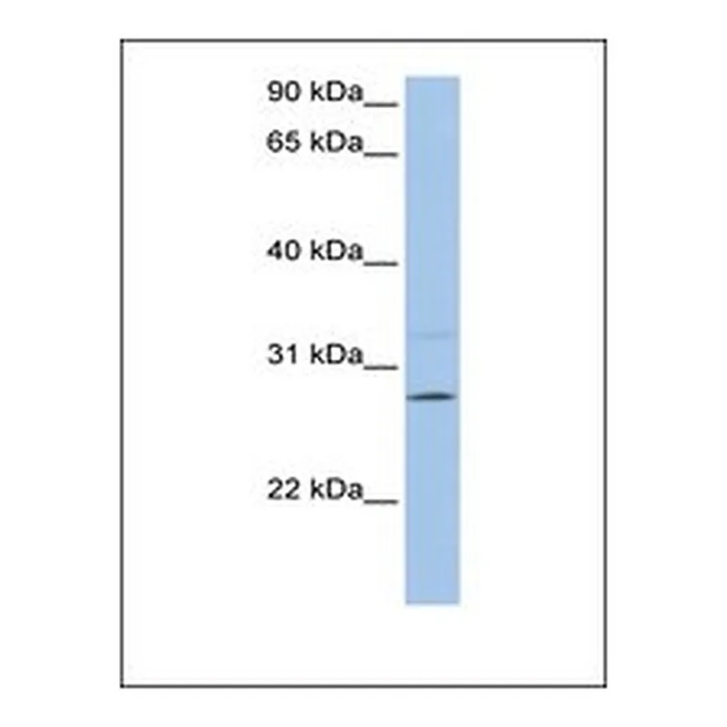 Merck Anti-PEMT