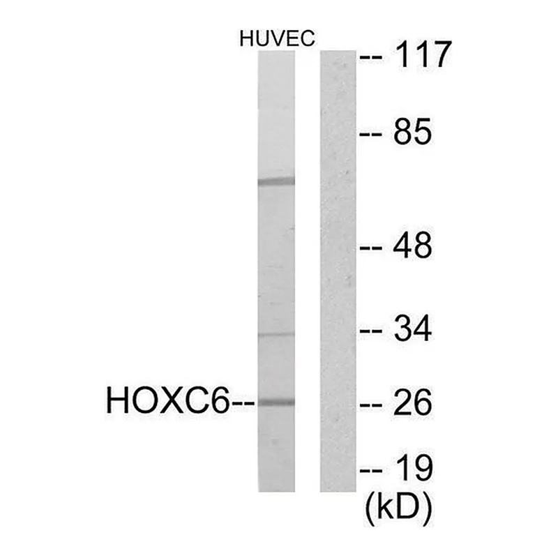 Merck Anti-HOXC6 antibody produced in rabbit
