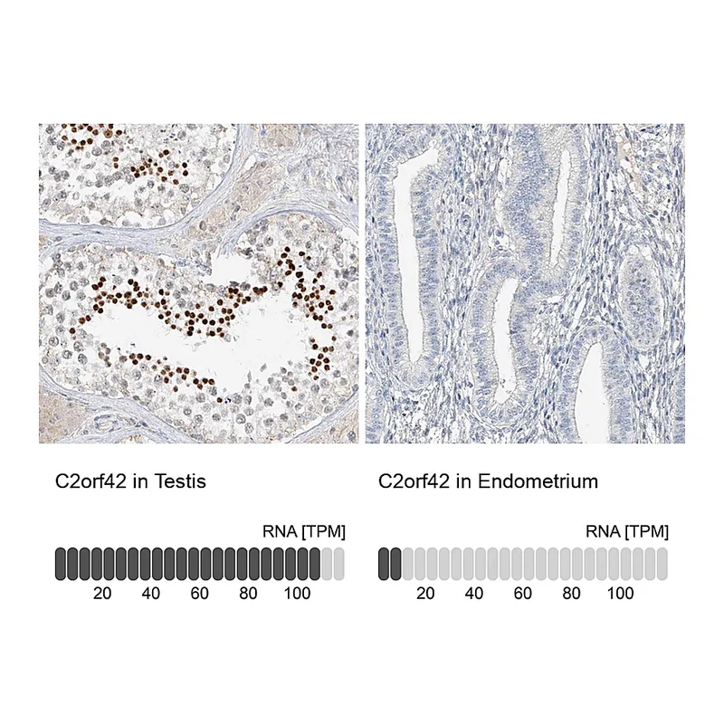 Atlas Antibodies Anti-C2orf42 Antibody