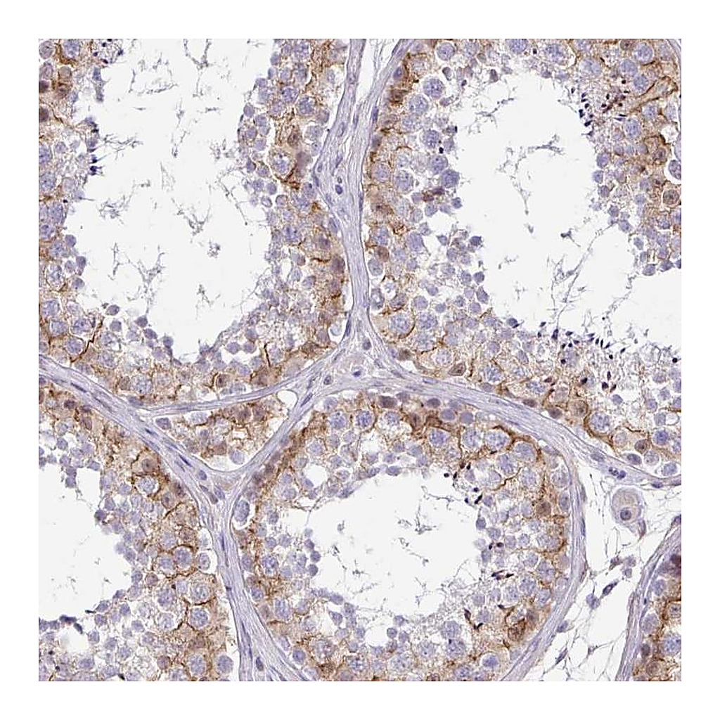 Atlas Antibodies Anti-C2orf61 Antibody