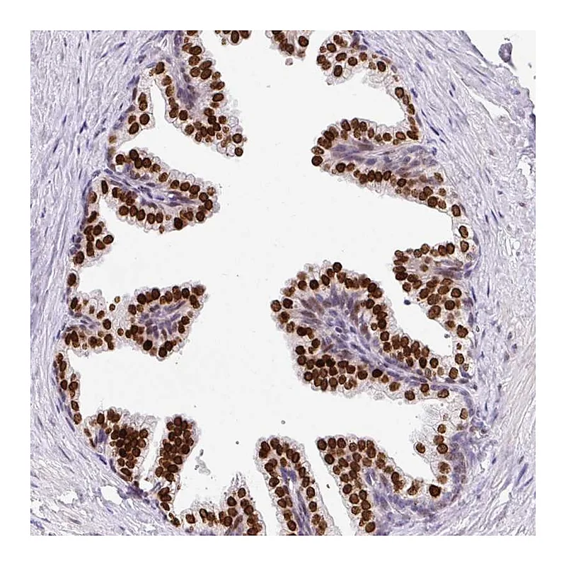 Atlas Antibodies Anti-C2orf71 Antibody