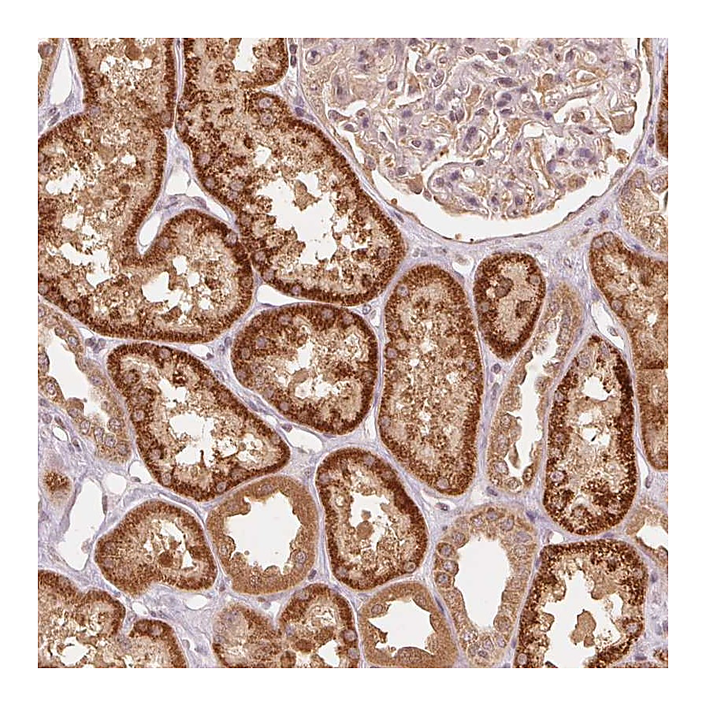 Atlas Antibodies Anti-C2orf73 Antibody