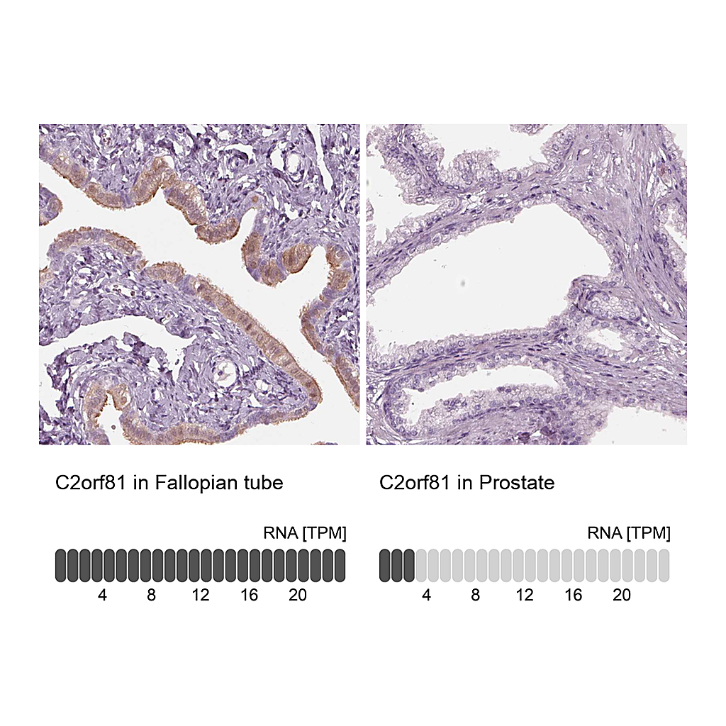 Atlas Antibodies Anti-C2orf81 Antibody