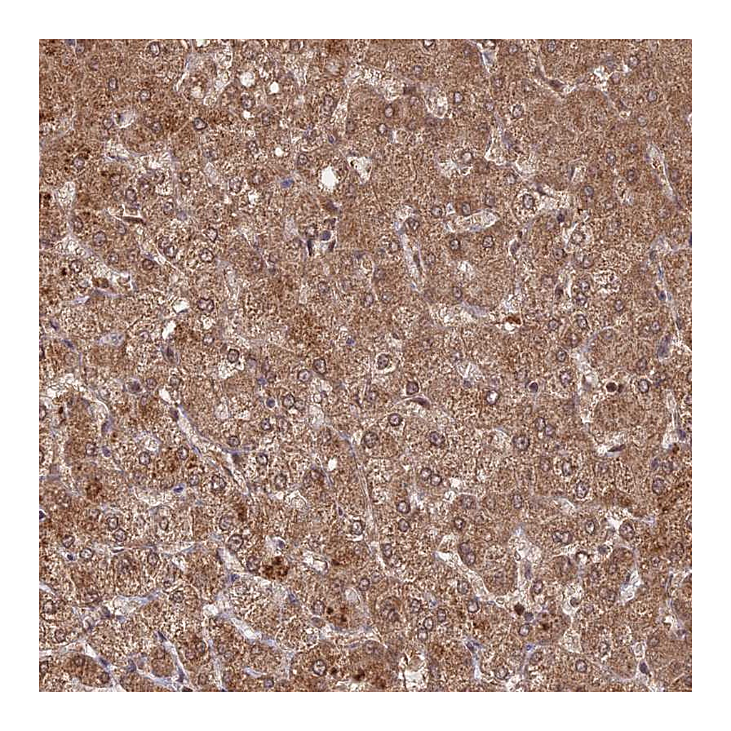 Atlas Antibodies Anti-C2orf91 Antibody