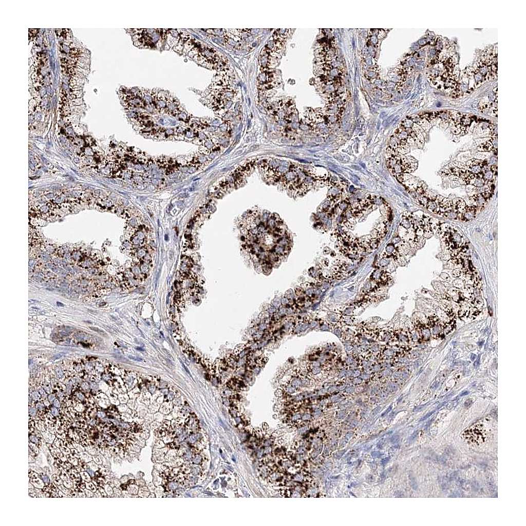 Atlas Antibodies Anti-C3orf38 Antibody