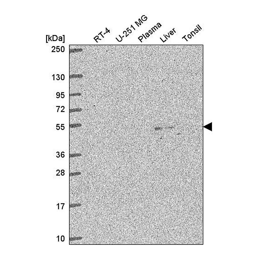 Atlas Antibodies Anti-C3orf67 Antibody