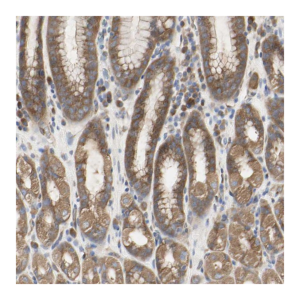 Atlas Antibodies Anti-C3orf52 Antibody