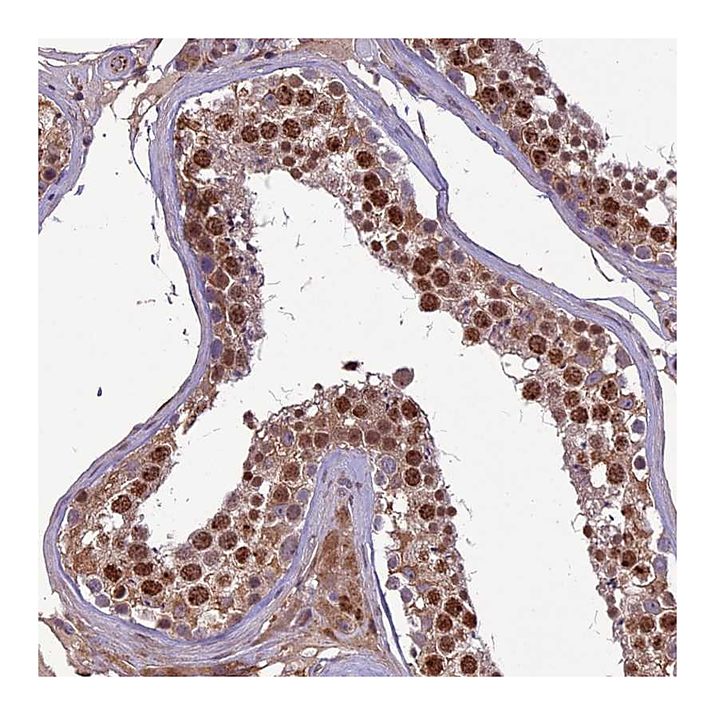 Atlas Antibodies Anti-C3orf70 Antibody
