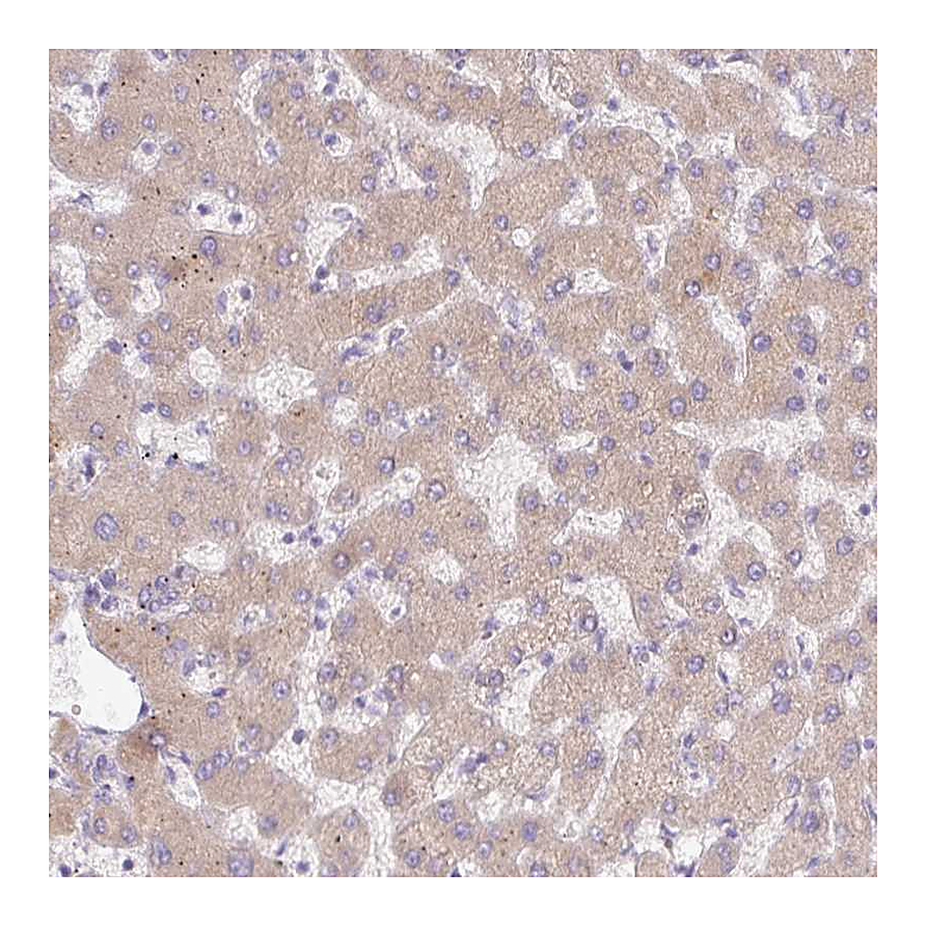 Atlas Antibodies Anti-C4A Antibody