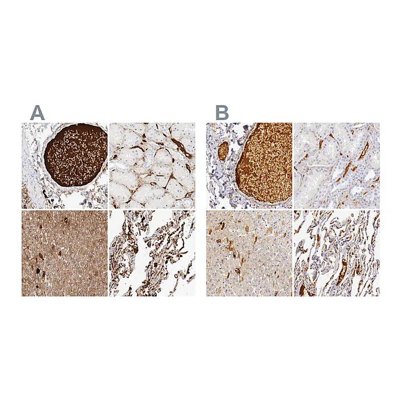 Atlas Antibodies Anti-C4BPA Antibody