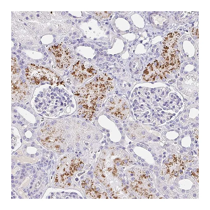 Atlas Antibodies Anti-C4orf17 Antibody