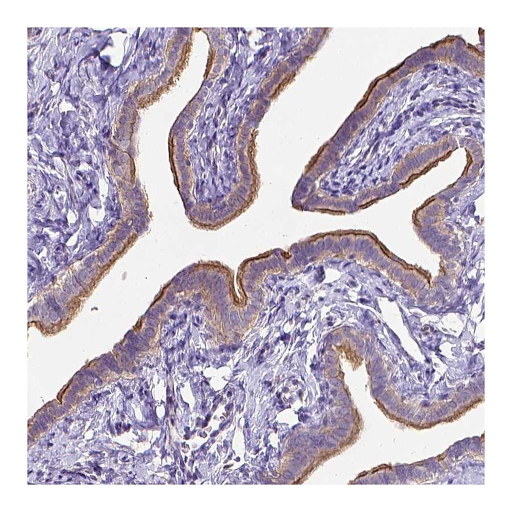 Atlas Antibodies Anti-C4orf22 Antibody