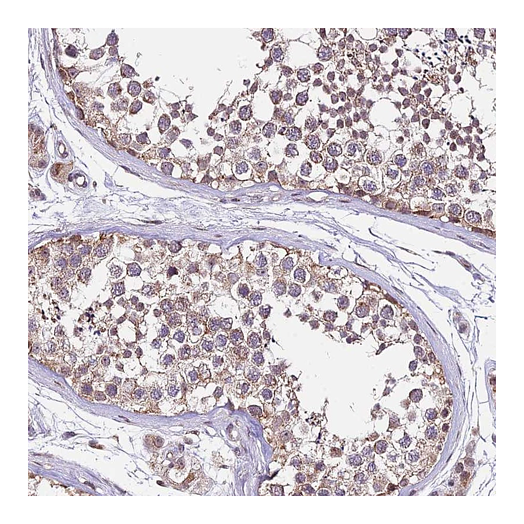 Atlas Antibodies Anti-C4orf47 Antibody