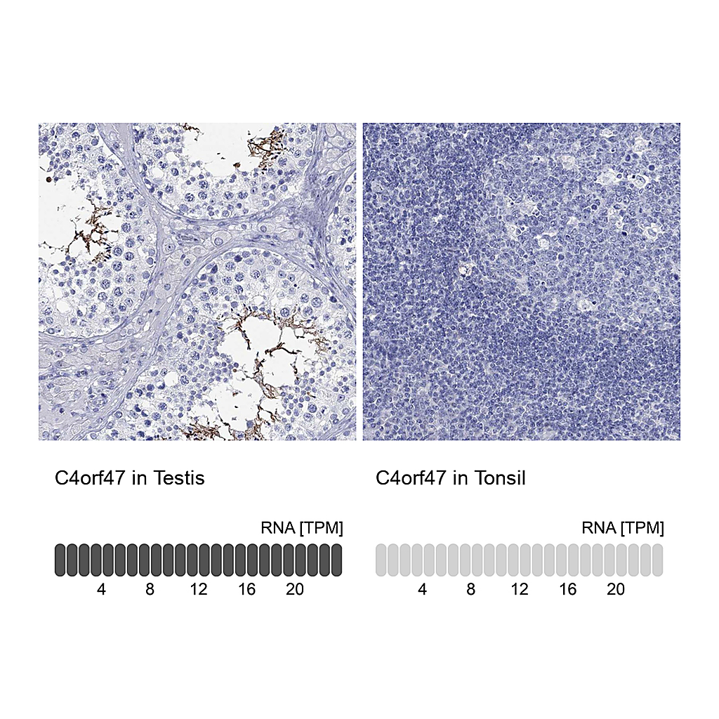 Atlas Antibodies Anti-C4orf47 Antibody