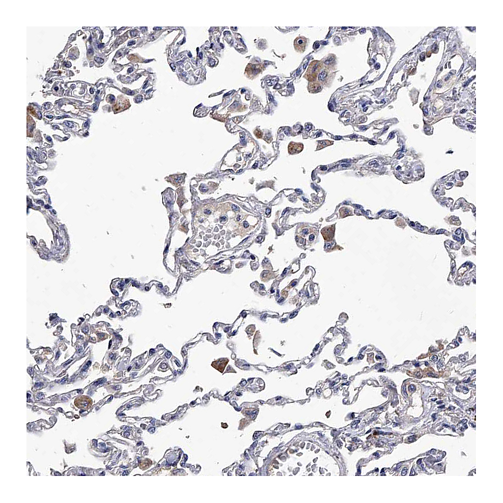 Atlas Antibodies Anti-C5 Antibody