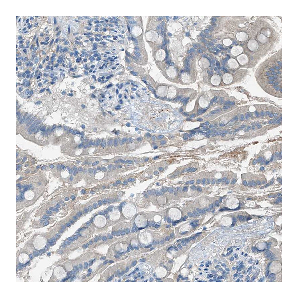 Atlas Antibodies Anti-C5AR2 Antibody