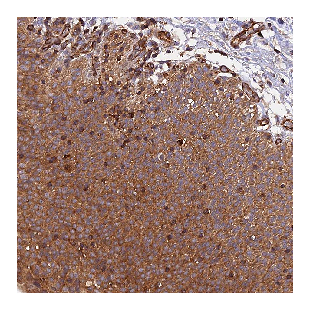 Atlas Antibodies Anti-C5orf22 Antibody