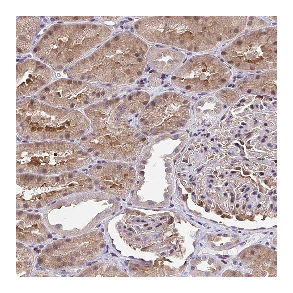 Atlas Antibodies Anti-C5orf24 Antibody