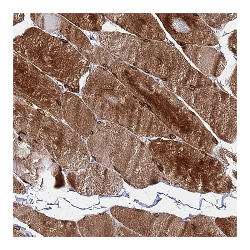Atlas Antibodies Anti-C5orf34 Antibody