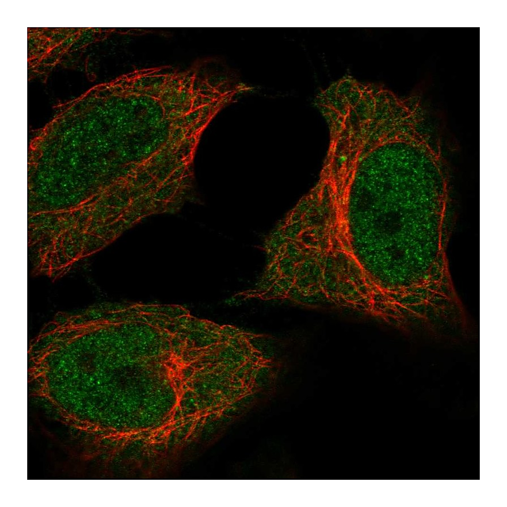 Atlas Antibodies Anti-C5orf51 Antibody