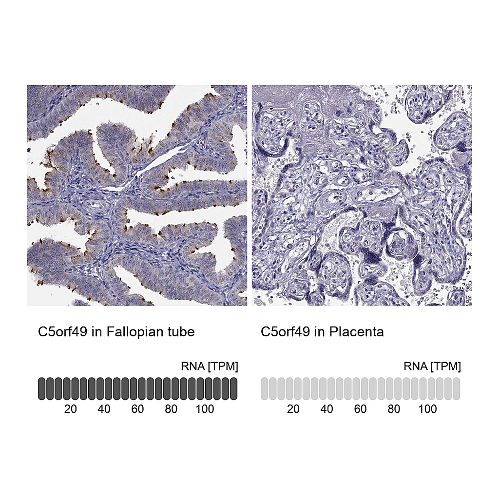 Atlas Antibodies Anti-C5orf49 Antibody