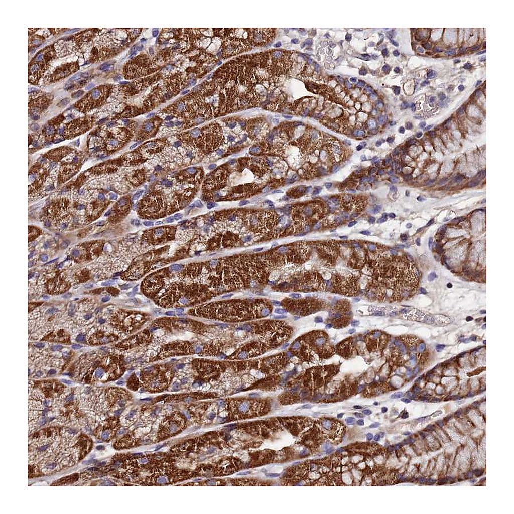 Atlas Antibodies Anti-C5orf63 Antibody