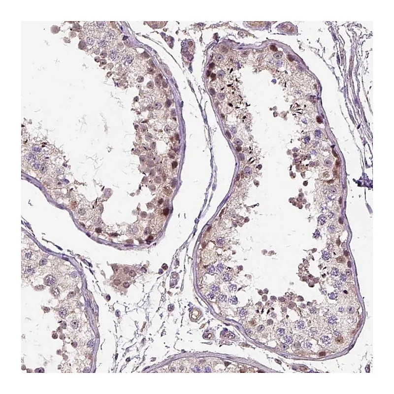 Atlas Antibodies Anti-C6orf106 Antibody