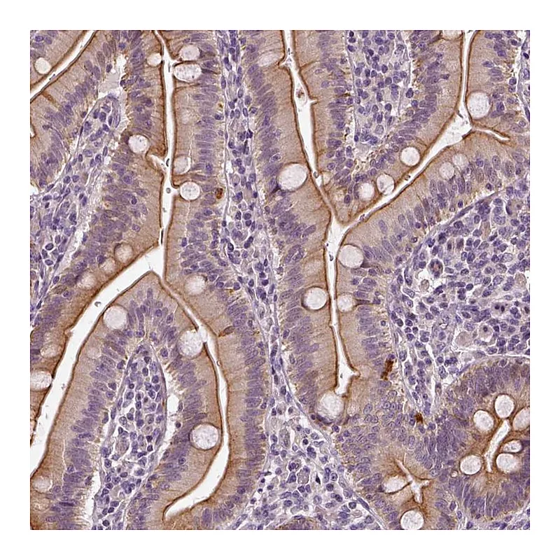 Atlas Antibodies Anti-C6orf106 Antibody