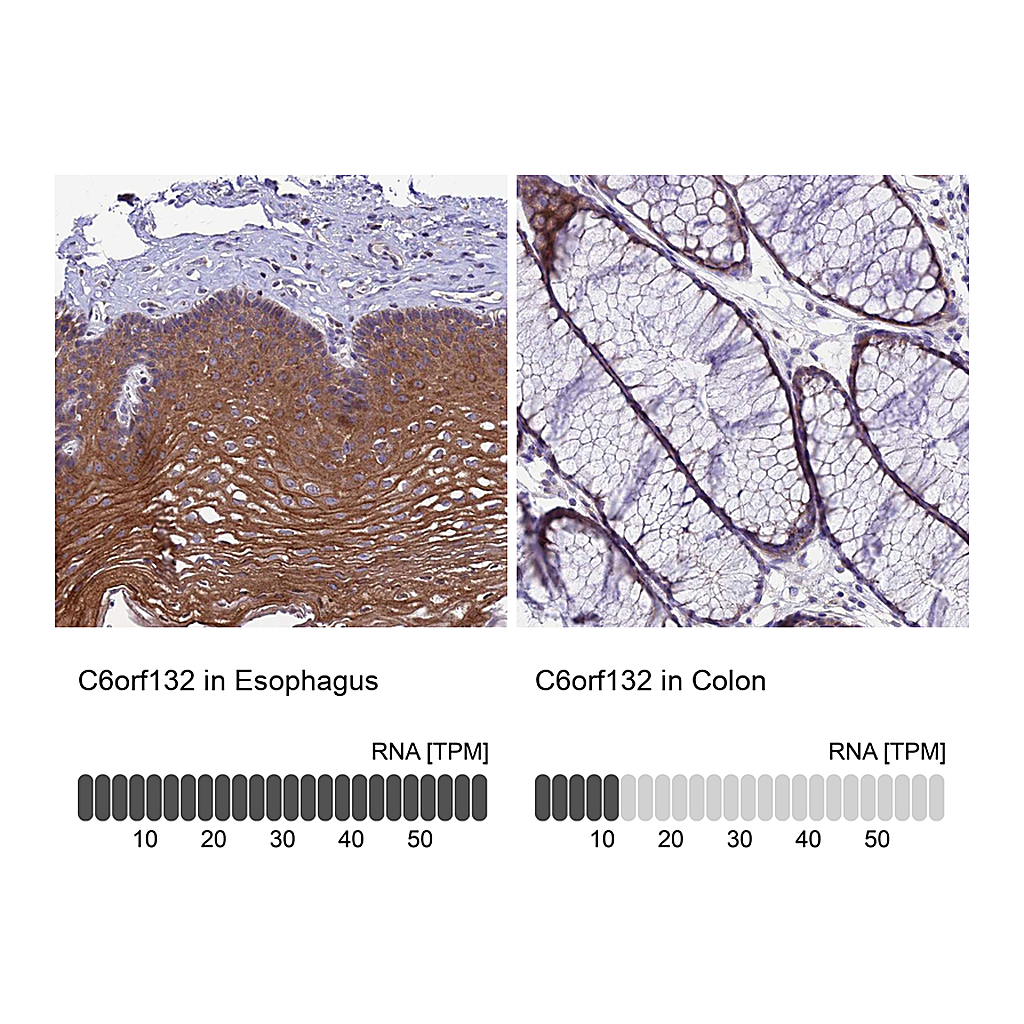 Atlas Antibodies Anti-C6orf132 Antibody