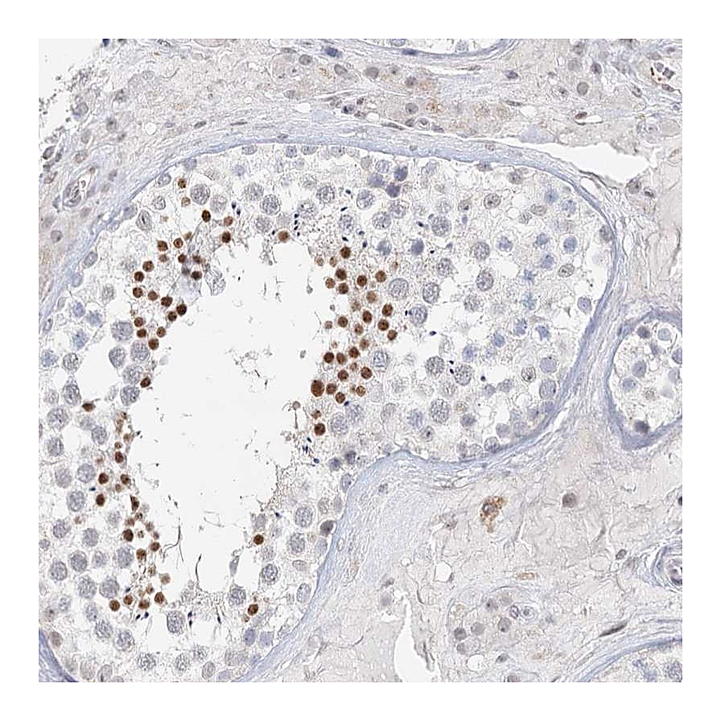 Atlas Antibodies Anti-C6orf222 Antibody