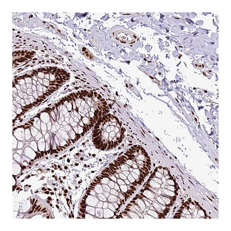 Atlas Antibodies Anti-C6orf226 Antibody