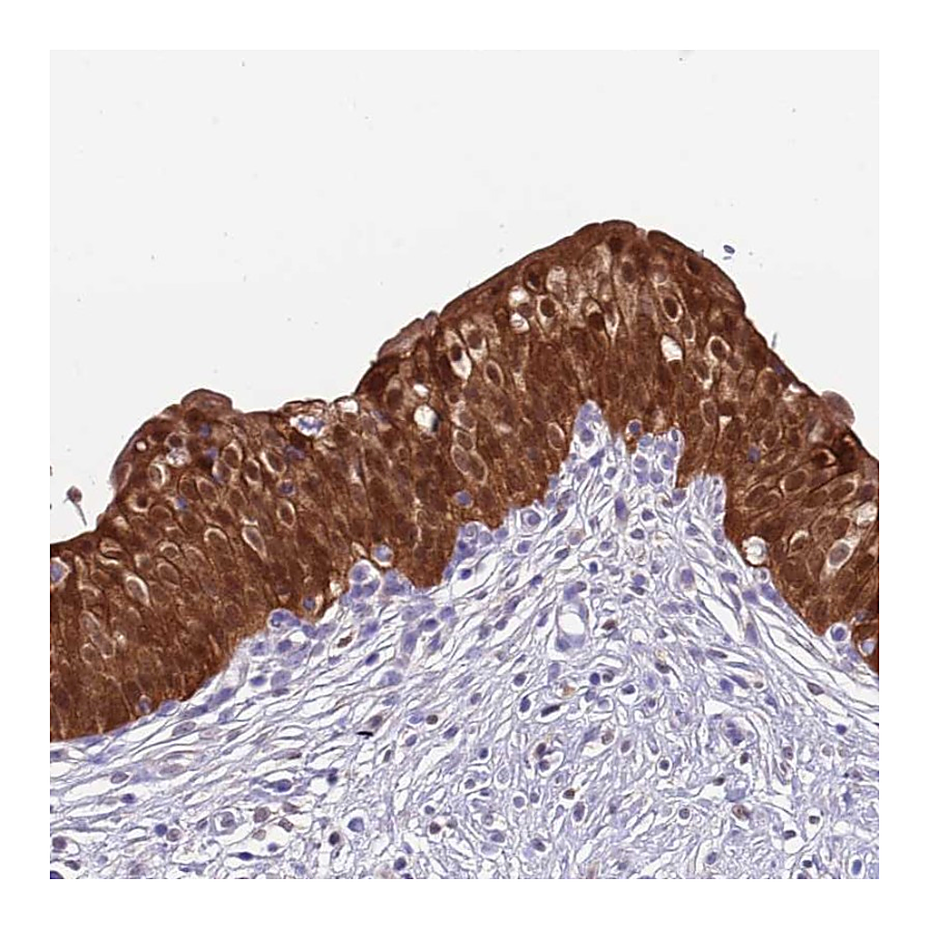 Atlas Antibodies Anti-C6orf47 Antibody