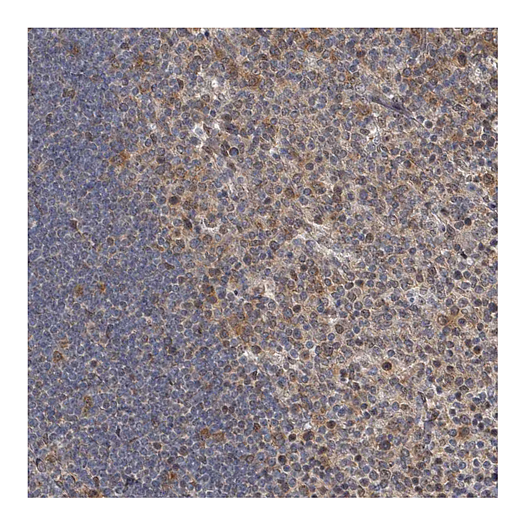 Atlas Antibodies Anti-C7orf26 Antibody